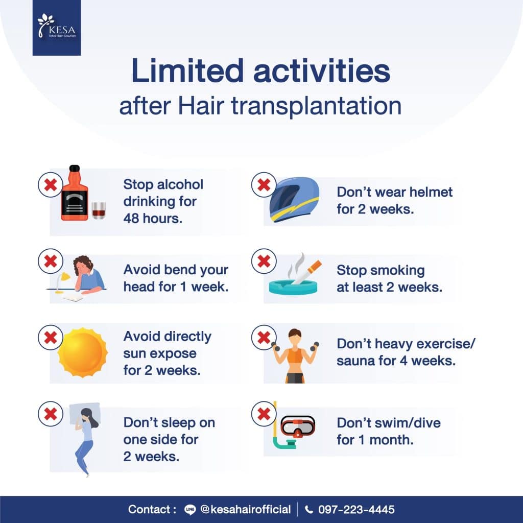 hair transplant preparation