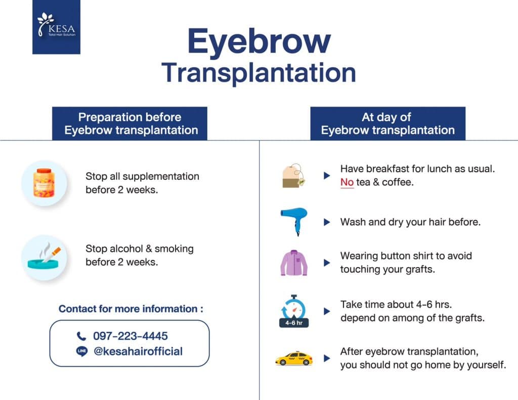Eyebrow transplant preparation