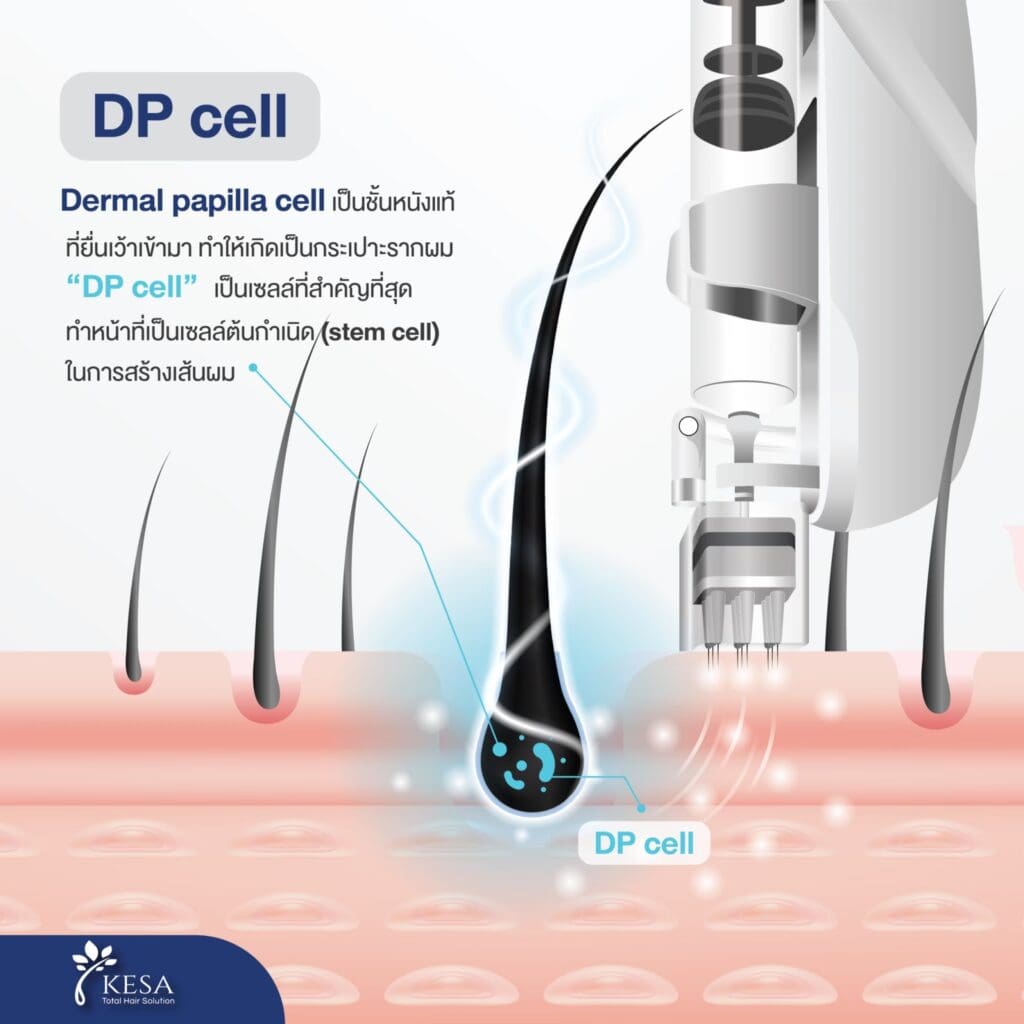 DP cell