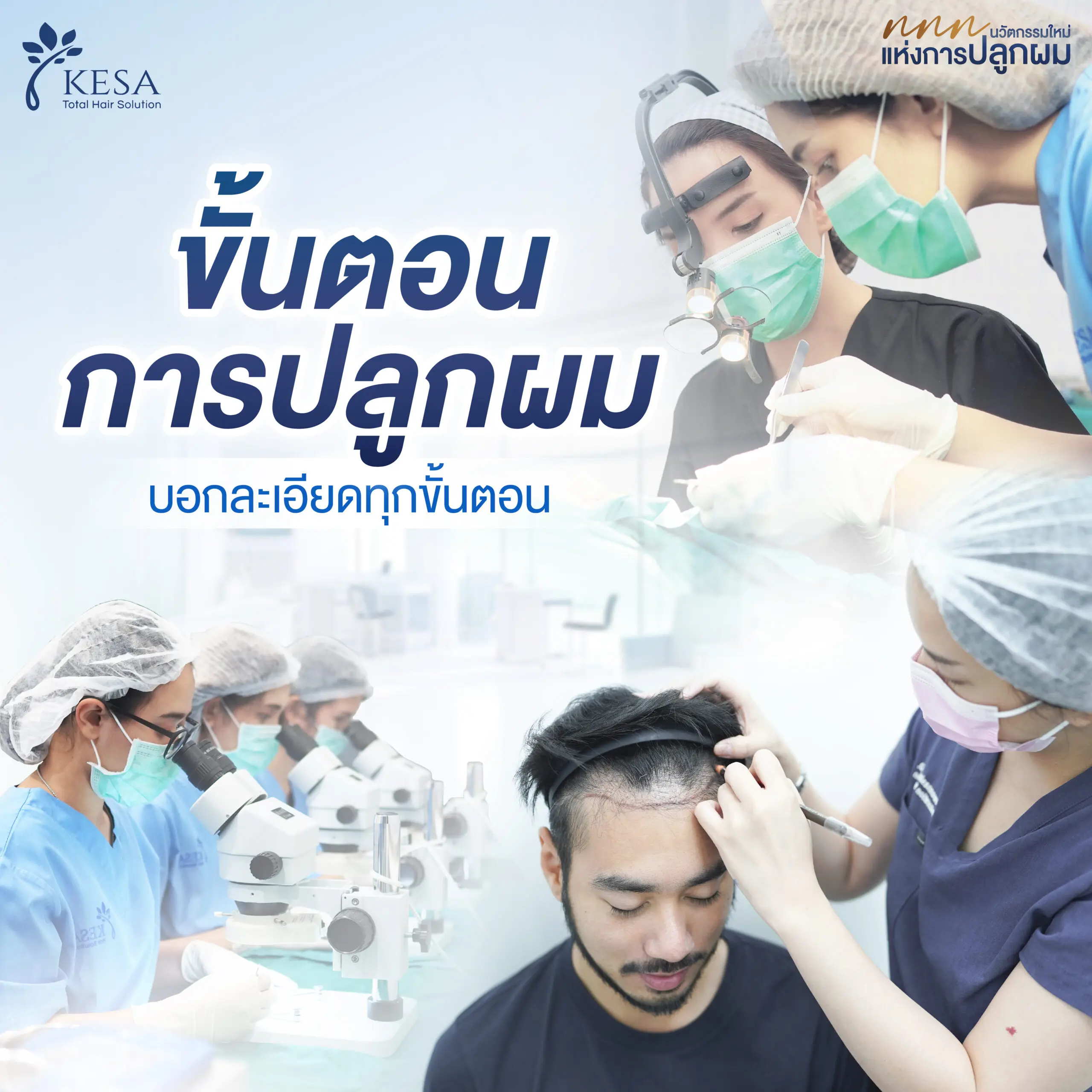6 Steps of Hair Transplantation in Thailand